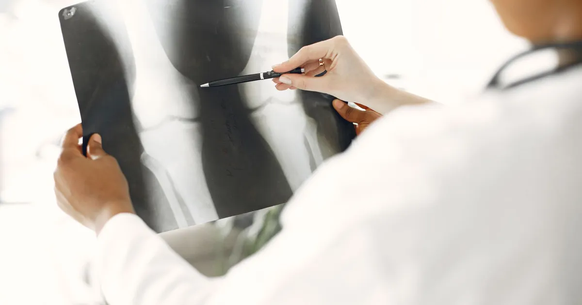 A medical professional examining a leg X-ray