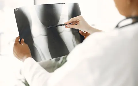 A medical professional examining a leg X-ray