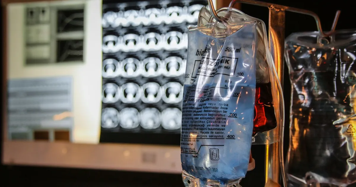 Intravenous fluid bags hanging in front of medical imaging screens in a hospital