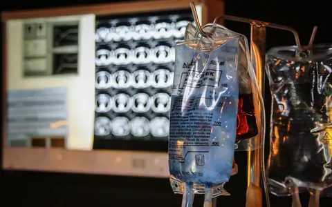 Intravenous fluid bags hanging in front of medical imaging screens in a hospital