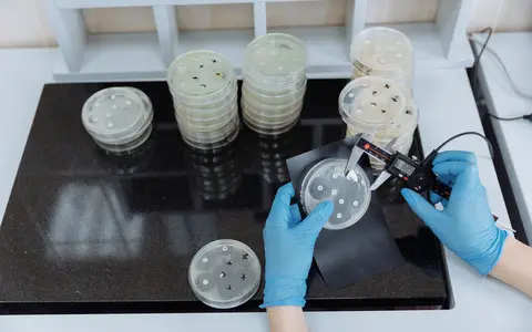Scientist measuring bacteria growth in petri dishes under sterile lab conditions