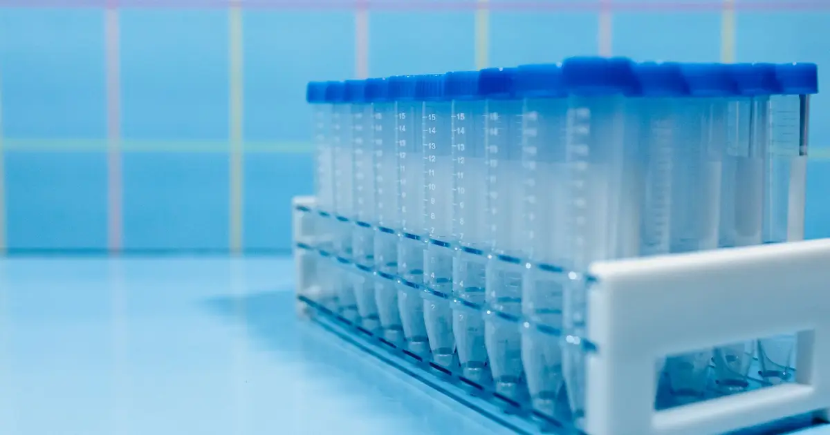 Laboratory test tubes in a plastic rack on a reflective blue surface