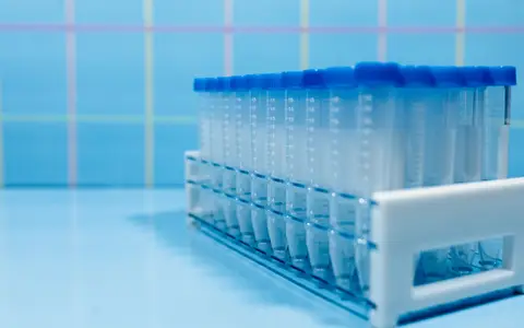 Laboratory test tubes in a plastic rack on a reflective blue surface