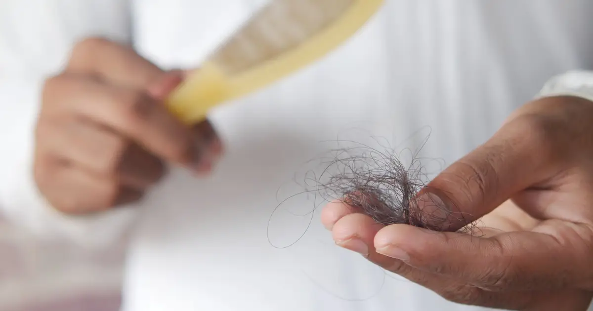 A detailed image showing hair loss with a comb in hand, symbolizing alopecia and related issues