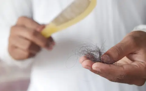 A detailed image showing hair loss with a comb in hand, symbolizing alopecia and related issues