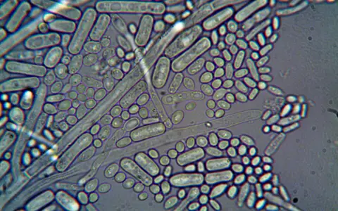 Detailed microscopic imagery of microorganisms at high magnification