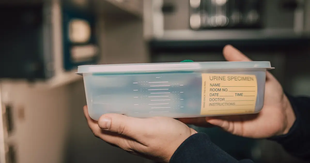 Hands holding a plastic urine specimen container with a blank label in a laboratory