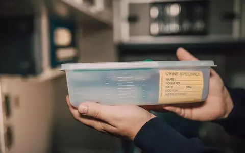 Hands holding a plastic urine specimen container with a blank label in a laboratory