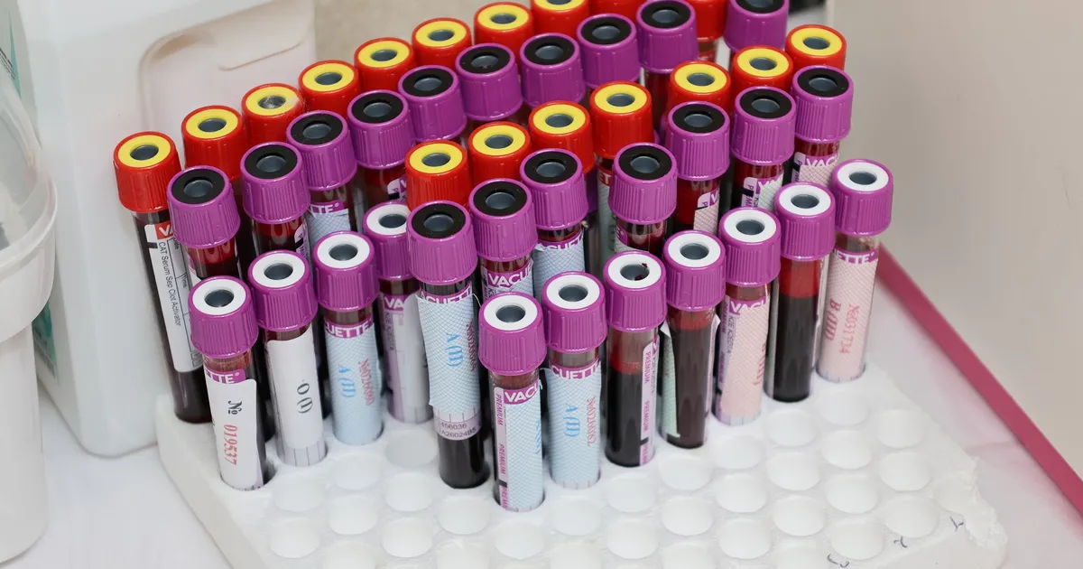 Rows of blood sample vials in a laboratory, ready for analysis