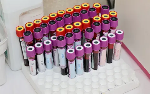 Rows of blood sample vials in a laboratory, ready for analysis