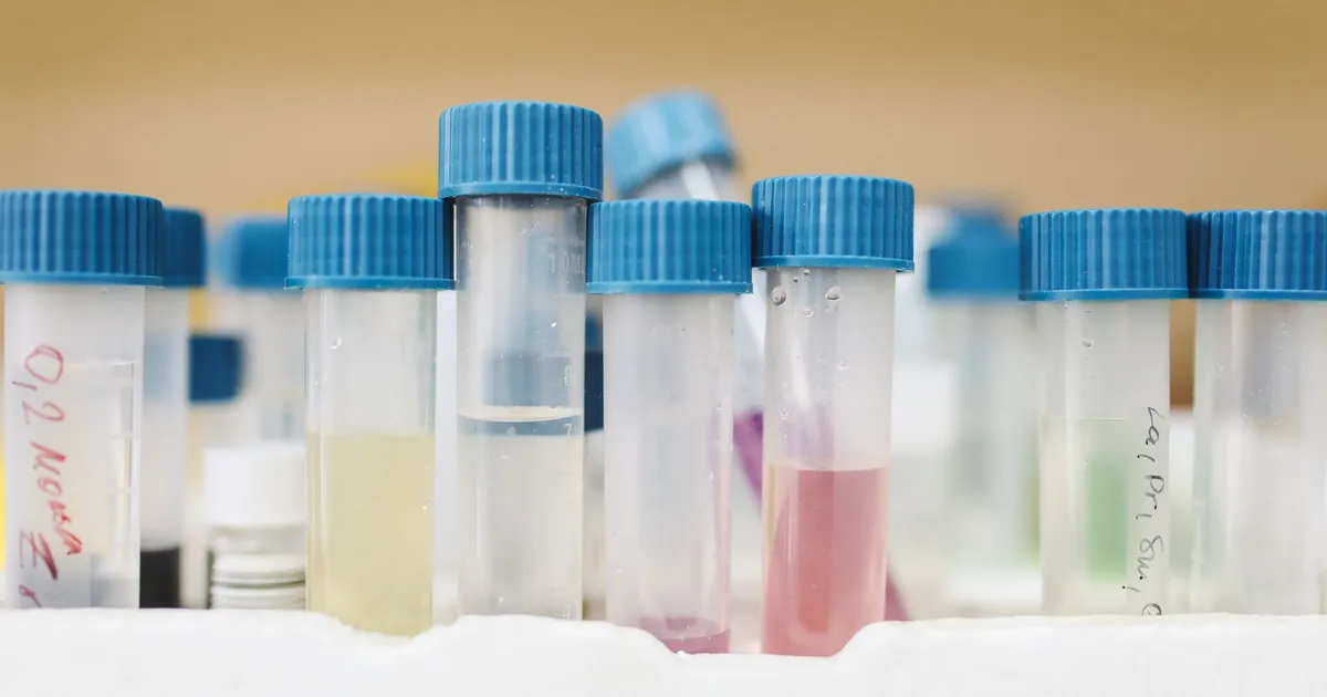 Close-up of test tubes with blue caps in a laboratory