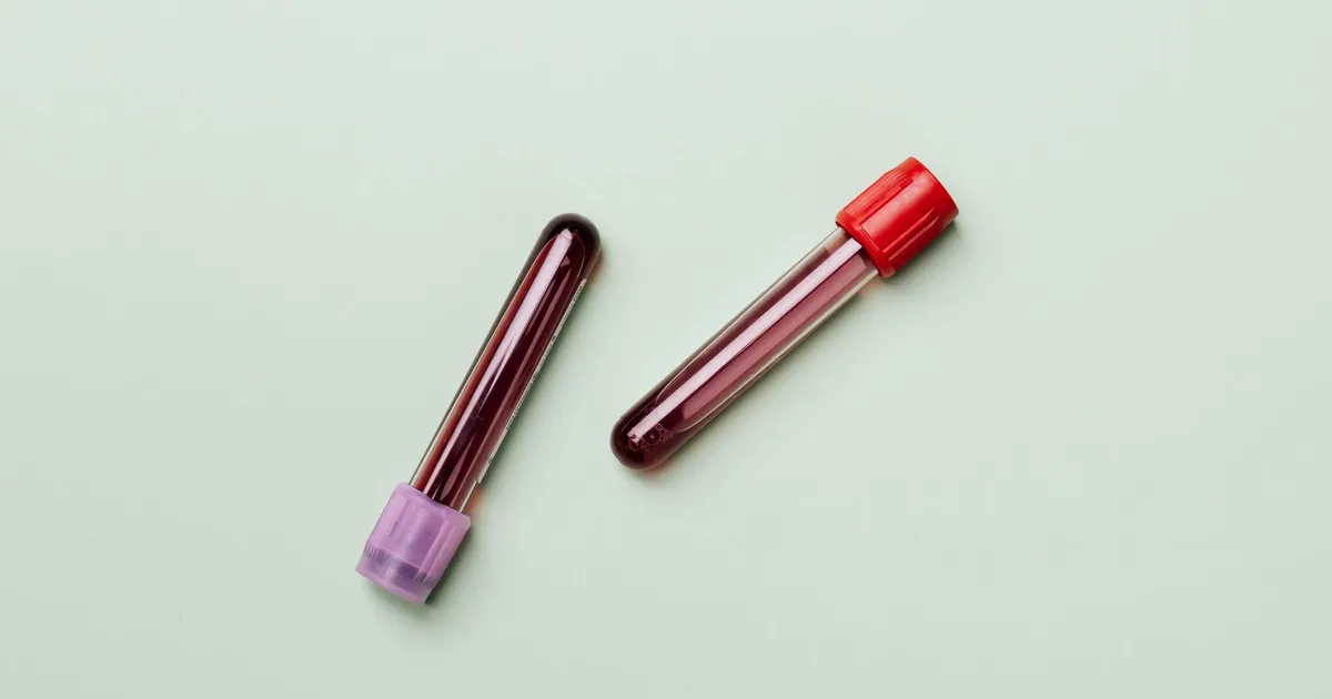 Blood samples in test tubes