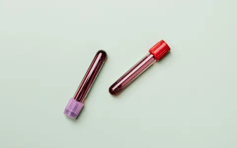 Blood samples in test tubes