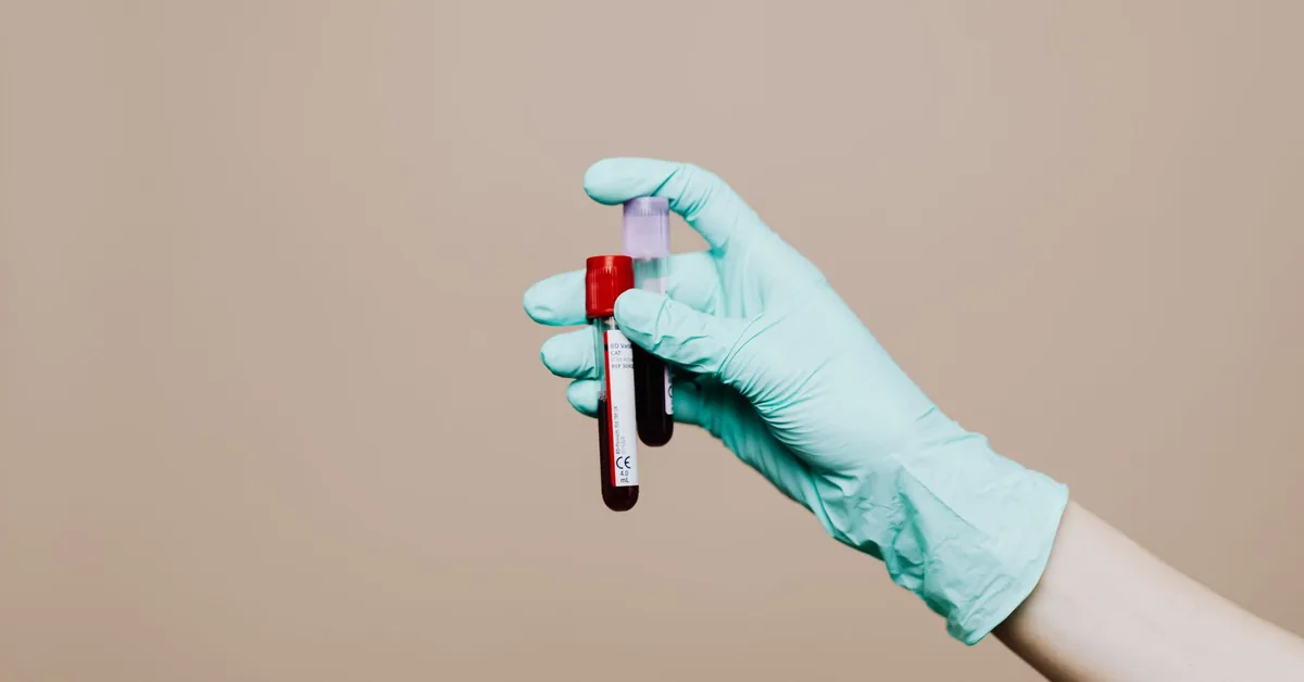 A gloved hand holding a blood sample tube in a lab