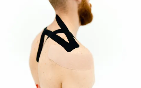 Black kinesiology tape applied to a person's shoulder